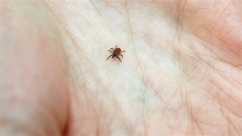 Don't panic if you get bit by a tick. Here are 5 tips to minimize Lyme ...