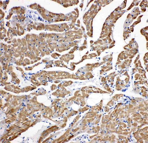 Cardiac Troponin C Antibody (PA5-80171)