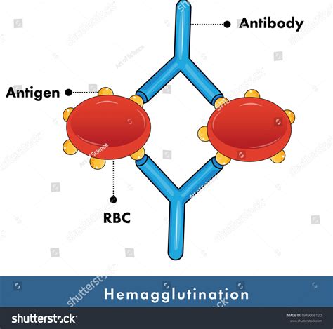 Hemagglutination Assay Used Blood Grouping Blood: เวกเตอร์สต็อก (ปลอดค่าลิขสิทธิ์) 1949098120 ...