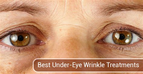 3 Best Cosmetic Treatments For Under-Eye Wrinkles | Skouras Eye & Cosmetic