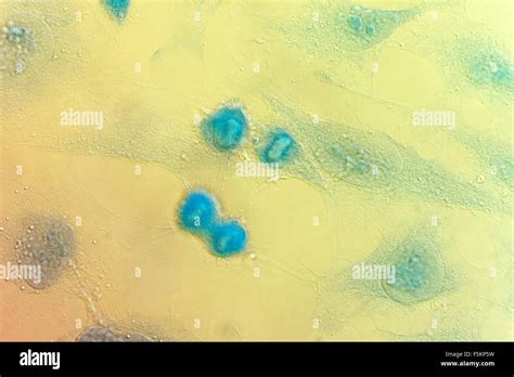 HeLa cervical cancer cells, stained with Coomassie blue, under differencial interference ...