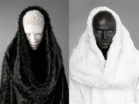 Диалоги | Shaun ross, Melanism, Albinism