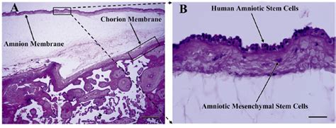 Isolation and Partial Characterization of Human Amniotic Epithelial Cells: The Effect of Trypsin ...
