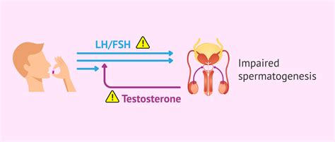 Teratozoospermia due to taking certain drugs