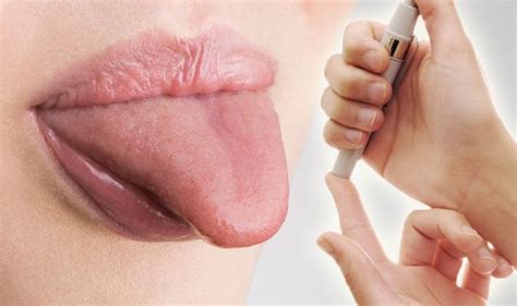 Diabetes type 2 symptoms: High blood sugar signs on your tongue ...