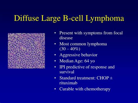 Diffuse Large B Cell Lymphoma Symptoms