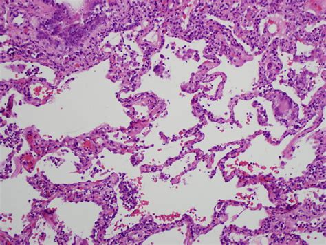 What is the Difference Between Cytology and Histology - Pediaa.Com