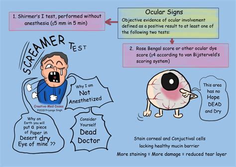 Sjogren Syndrome: Dry Eyes and Dry Mouth - Creative Med Doses