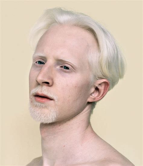 Mini Title — Personal - ericnehr | Albino men, Albino human, Albino model