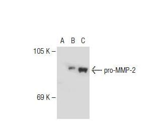 MMP2 Antibody (2C1) | SCBT - Santa Cruz Biotechnology