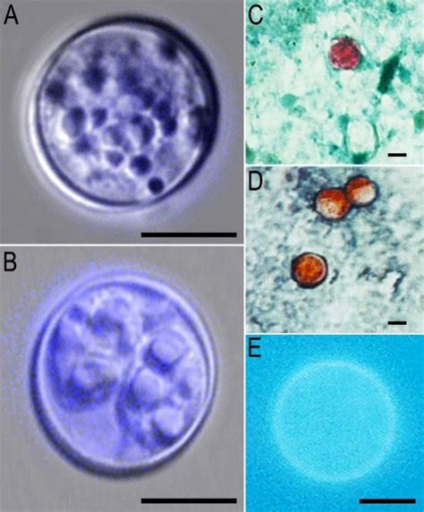 Cyclospora Infection: Causes, Symptoms, Treatment, Prevention - Public ...