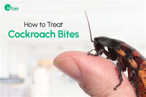 Cockroach Bite : Check Symptoms, Treatment and Prevention Tips