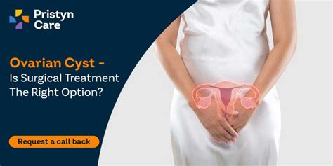 Ovarian Cyst Treatment- Is Surgery The Right Option? - Pristyn Care