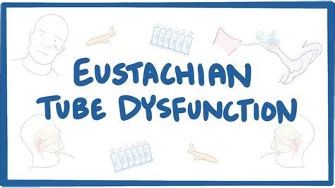 Eustachian tube dysfunction (ETD) - causes, symptoms, diagnosis, treatme... | Eustachian tube ...