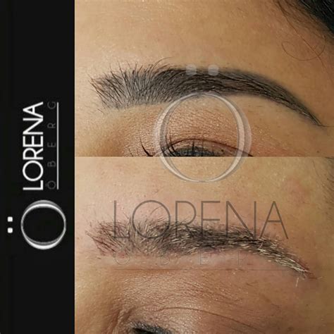 11+ Permanent Eyebrow Tattoo Removal Before And After Background | Eyebrow Ideas