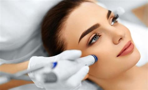 Pros and Cons of Microdermabrasion for Acne Scars