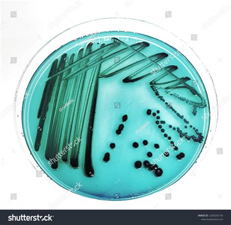 6 imágenes de Hektoen enteric agar - Imágenes, fotos y vectores de stock | Shutterstock