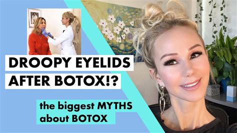 BAD BOTOX!? What goes WRONG when you get botched botox! - YouTube