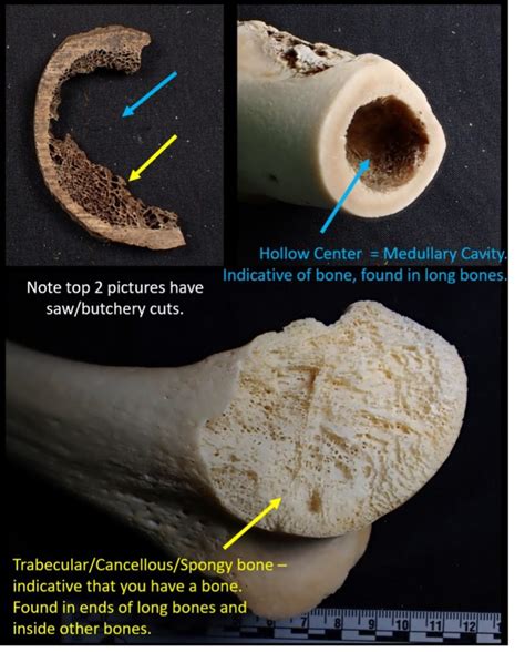 Using OsteoID – OsteoID Bone Identification