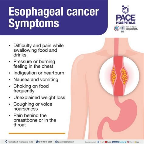 Esophageal Cancer - Symptoms, Causes, Complications & Prevention