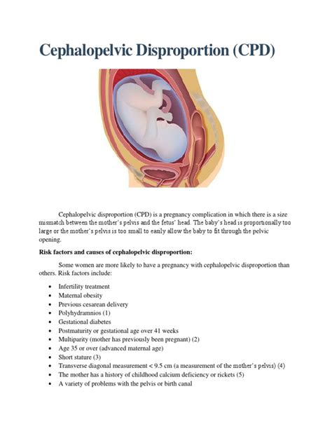 Cephalopelvic Disproportion | PDF | Childbirth | Motherhood