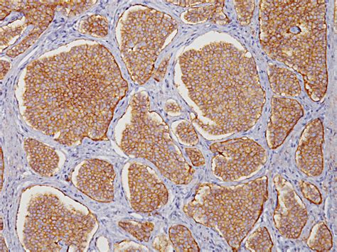 CD57 Antibody - Biocare Medical