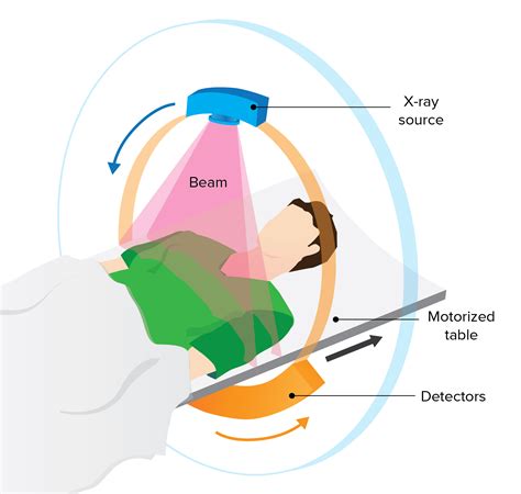 CT or computed tomography explained