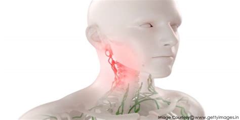 Symptoms of Lymph Node Cancer | Cancer