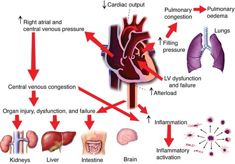 Organ dysfunction, injury and failure in acute heart failure: from pathophysiology to diagnosis ...