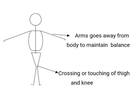 scissoring gait physiotherapy management - PHYSIO STUDY