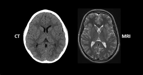 Ct Scan Vs MRI, Important things to know for a patient