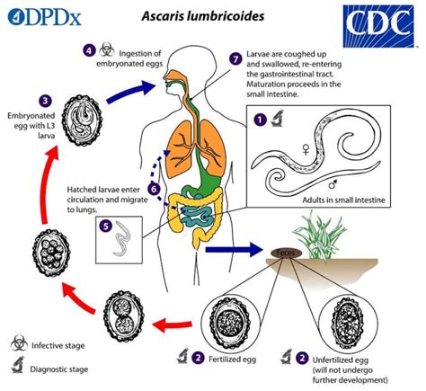 Ascaris lumbricoides- Life cycle, Pathogenicity, Clinical Manifestation