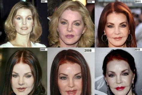 Priscilla Presley surgery transformations | Celebrity plastic surgery, Plastic surgery, Bad ...