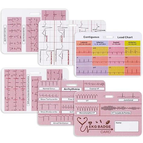 Buy EKG Cardiac Badge Card 3 Card Set, Stemi Badge Card EKG Telemetry Interpretation Badge Buddy ...