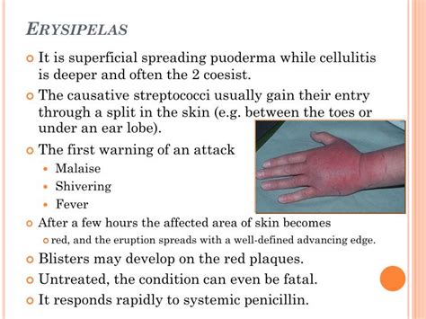 PPT - SKIN INFECTIONS PowerPoint Presentation - ID:287256