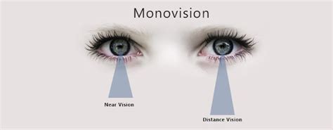 Vision Source Westview: Monovision Contact Lenses in Bunker Hill and ...