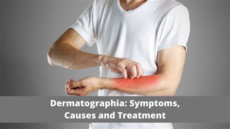 Dermatographia: Symptoms, Causes and Ayurvedic Treatment - VIMS