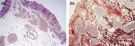 Alimentary Pharmacology & Therapeutics | Pharmacology Journal | Wiley Online Library