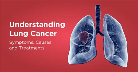 Lung Cancer: Symptoms, Causes, Types, Diagnose and Treatments