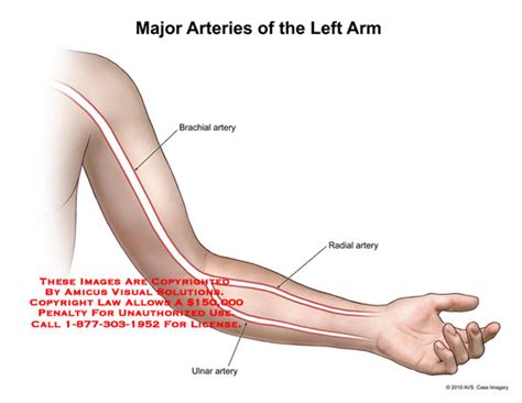 Major Arteries of the Left Arm