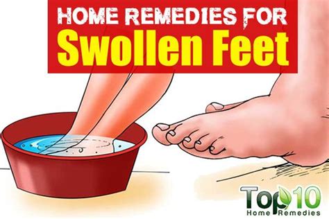 Home Remedies for Swollen Feet | Top 10 Home Remedies