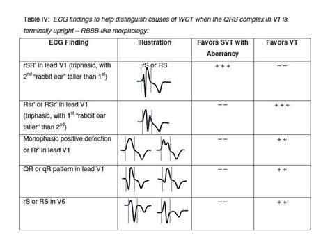 Differential Diagnosis of Wide QRS Complex Tachycardias - The Cardiology Advisor