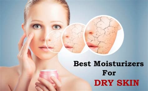 Best Moisturizers for Dry Skin