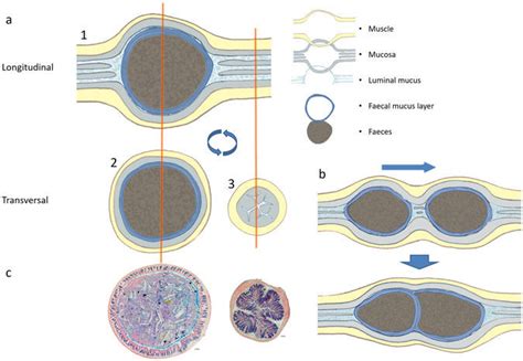 Schematic overview of mucus organisation situations as observed in ...