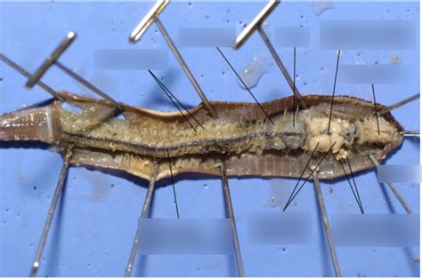 Worm Dissection (internal) Diagram | Quizlet