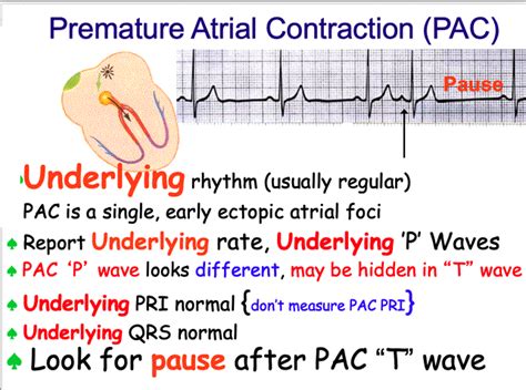 EKG Oct 12 - 16