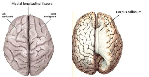 Cerebrum - Exam Questions - Anatomy QA