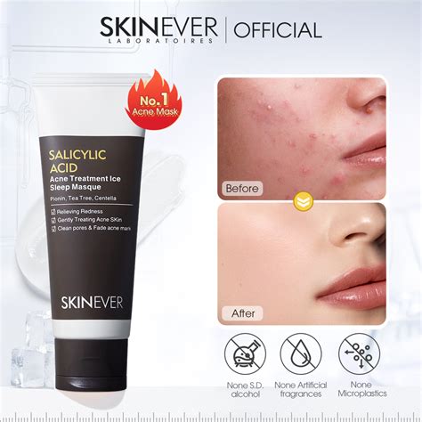 SKINEVER Salicylic Acid Pimple Remover Acne Treatment Ice Sleep Masque 55ML Pimple Patch Cosrx ...