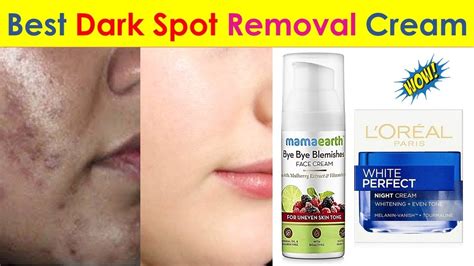 5 Best Dark Spot Removal Cream in India 2020 with Price - Anti-Pigmentation Creams - YouTube