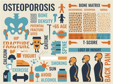 Osteoporosis Treatment: Do Bisphosphonates Such as Fosamax Cause Tooth Loss? - Gilmore Health News